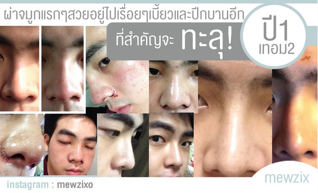 ศัลยกรรม
